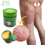 Fezema Graffi Eczema Cream – 20g Psoriasis & Dermatitis Treatment – Chinese Herbal Anti-Itch Ointment for Cracked, Scaly Skin Repair - Image 4