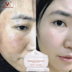 Mei Yan Qiong Bright Skin Cream 40g | Hydrating & Radiance-Boosting Face Cream with Collagen & Hyaluronic Acid | Lightweight Daily Moisturizer - Image 4