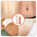 Bio-Oil Skincare Body Oil 200 ml – Scar & Stretchmark Serum, Moisturizer for Dry Skin, Non-Greasy & Non-Comedogenic - Image 6